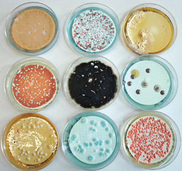 microbes